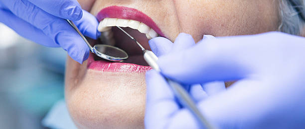 Best Emergency Dentist for Lost Fillings or Crowns in Ridgecrest, FL